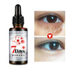 Remove Dark Circles & Wrinkles Eye Bags Serum Oil - 10ml