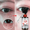 Remove Dark Circles & Wrinkles Eye Bags Serum Oil - 10ml