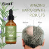 BUNEE Rosemary Hair Growth Serum Oil (Pack of 2/3)